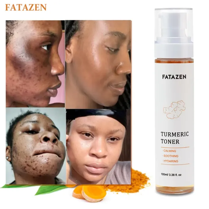 Fatazen Turmeric Toner – Éclat Naturel & Peau Unifiée