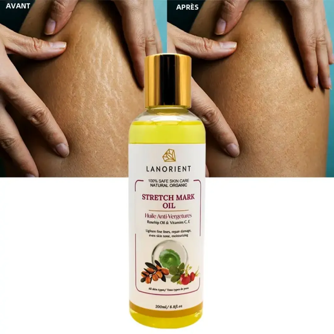 Huile Anti-Vergetures Naturelle – 200ml | Réparation Cutanée, Hydratation Profonde, Peau Élastique