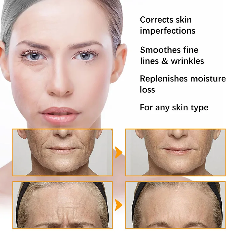 Crème Visage au Curcuma – Anti-Acné, Éclaircissante & Hydratante 50ml