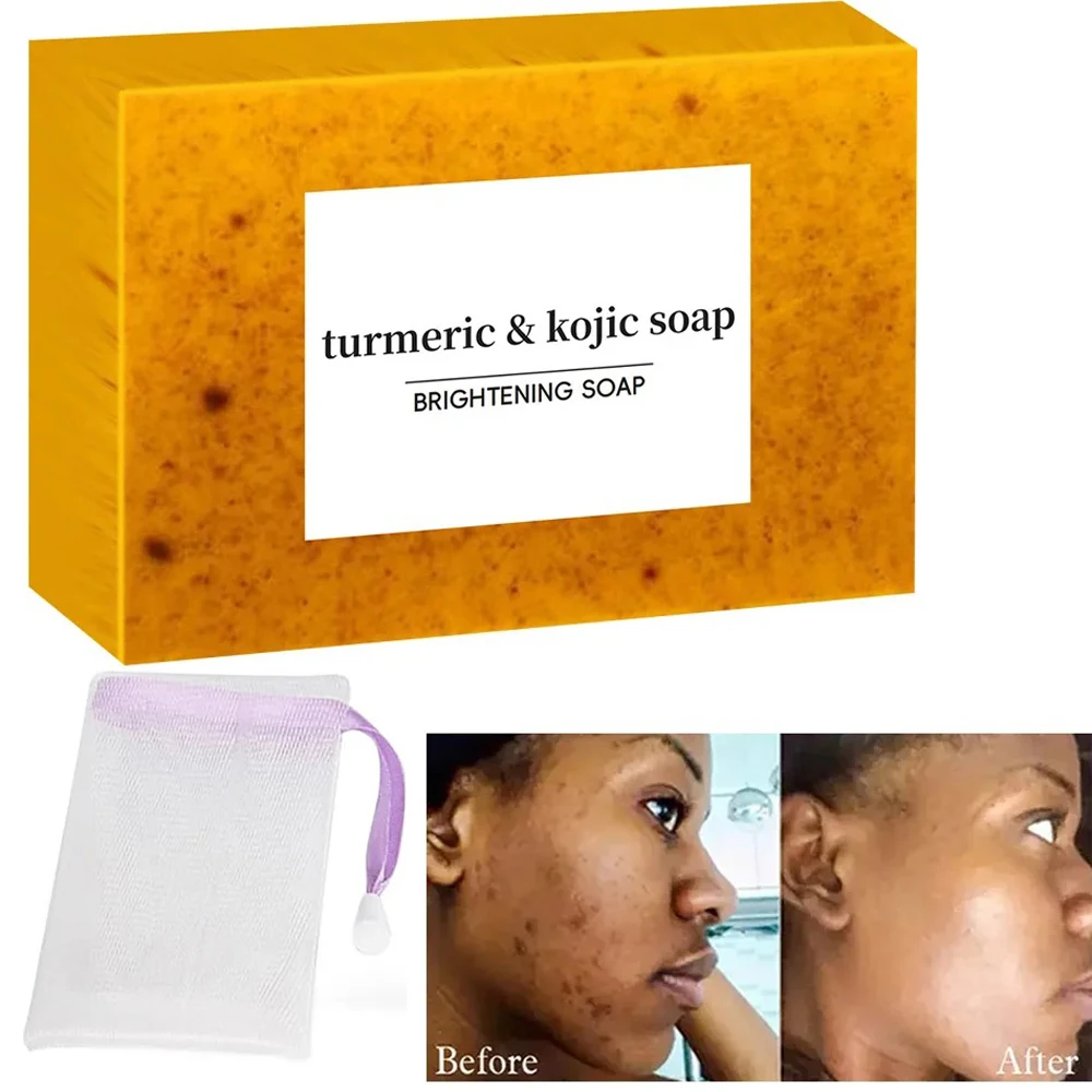 Savon Éclaircissant Curcuma & Acide Kojique – Anti-Taches, Teint Unifié, Peau Lumineuse