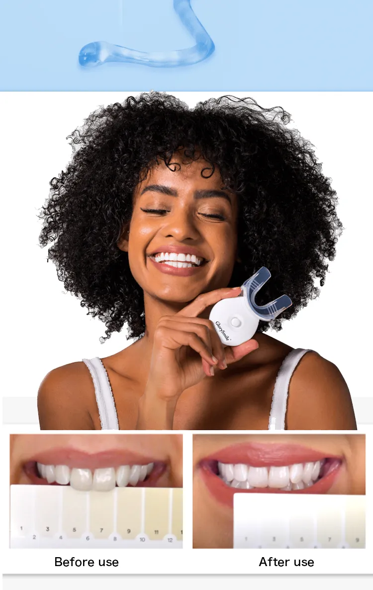 Kit Professionnel de Blanchiment des Dents GlorySmile – LED Bleue Rechargeable + 3 Gels Blanchissants – Système à Domicile avec Logo Personnalisable