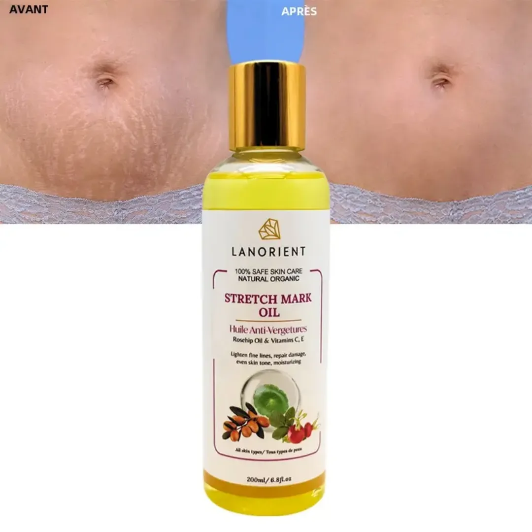 Huile Anti-Vergetures Naturelle – 200ml | Réparation Cutanée, Hydratation Profonde, Peau Élastique