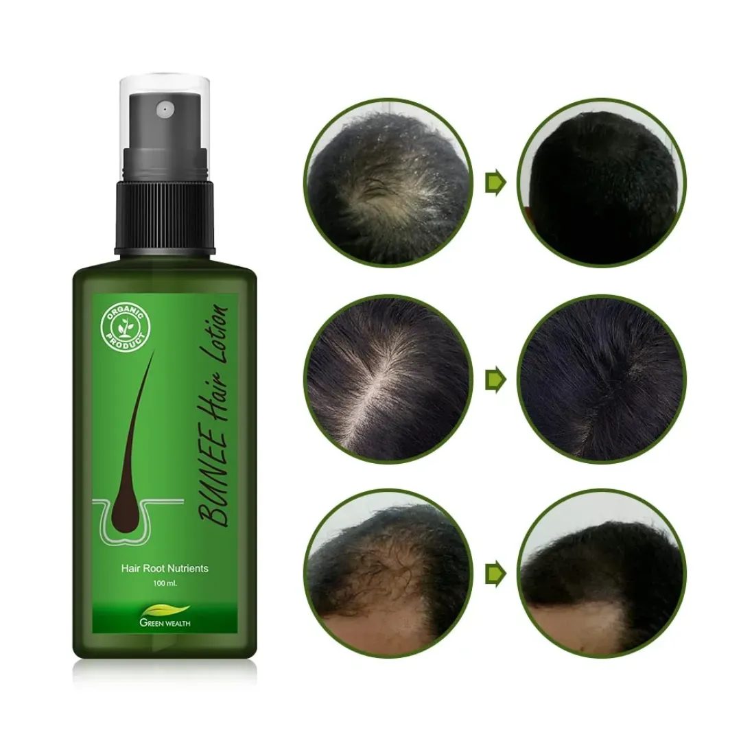 Lotion Capillaire BUNEE – Anti-Chute & Stimulation Rapide de la Pousse