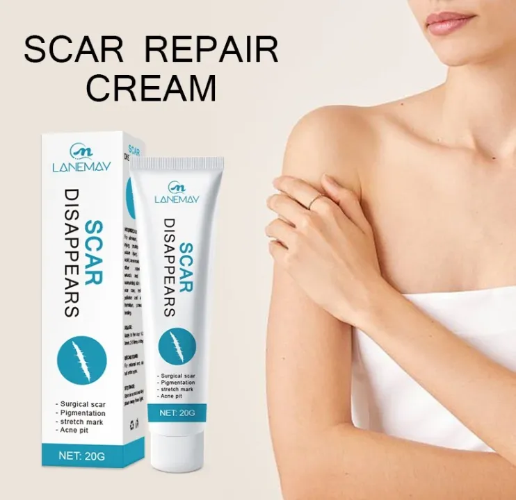 Crème Réparatrice Anti-Cicatrices & Vergetures – LANEMAY | Réduction des Taches, Soins du Visage et de la peau 