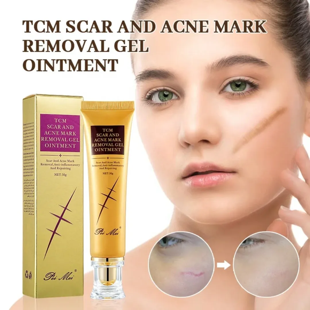 Meilleure crème originale pour cicatrices d'acné, vergetures et cicatrices de grossesse