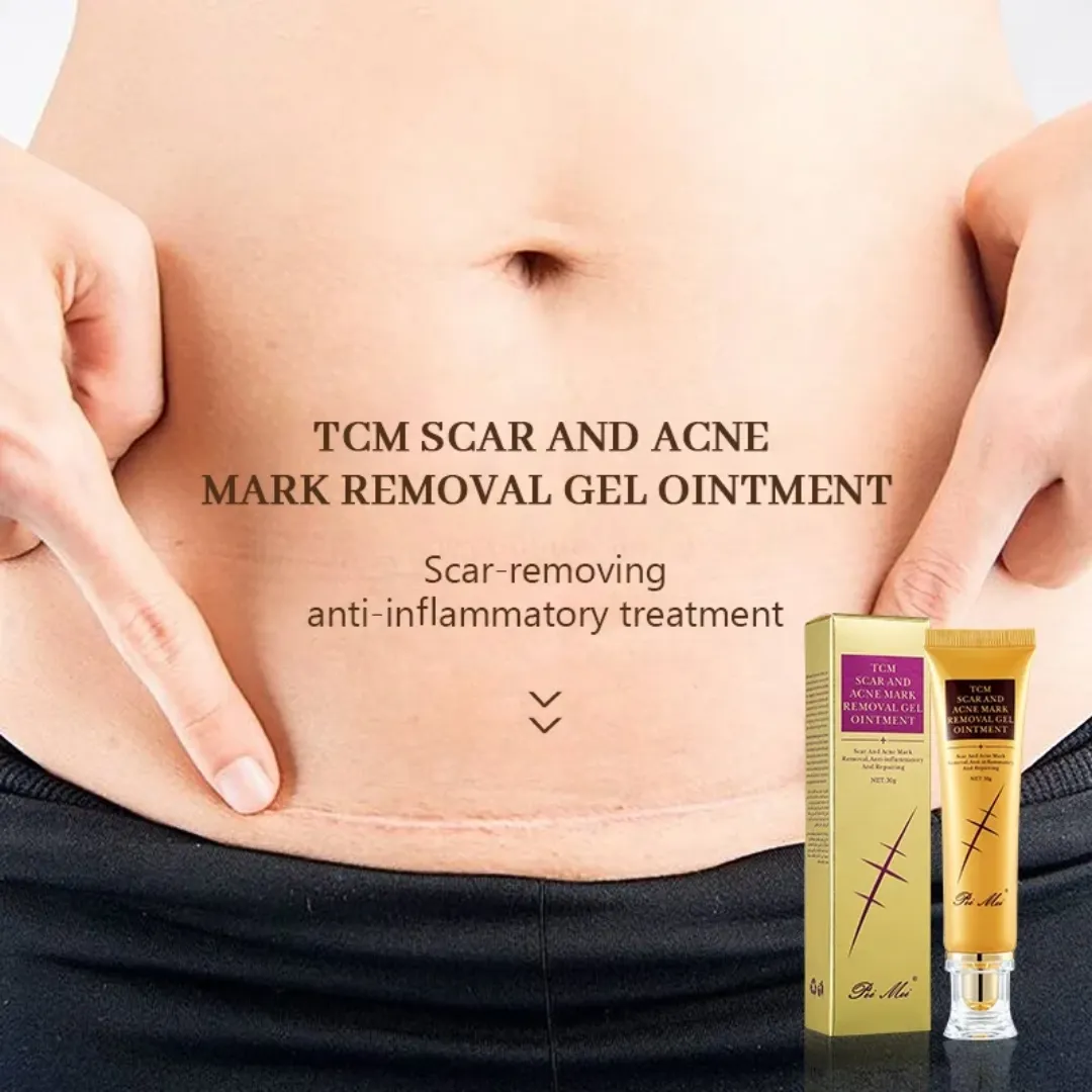 Meilleure crème originale pour cicatrices d'acné, vergetures et cicatrices de grossesse