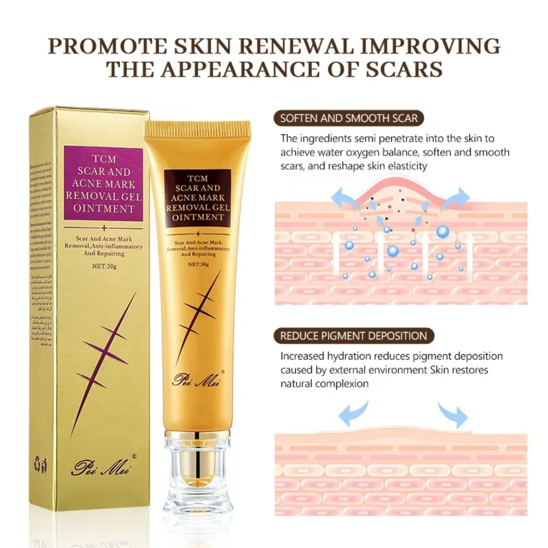 Meilleure crème originale pour cicatrices d'acné, vergetures et cicatrices de grossesse