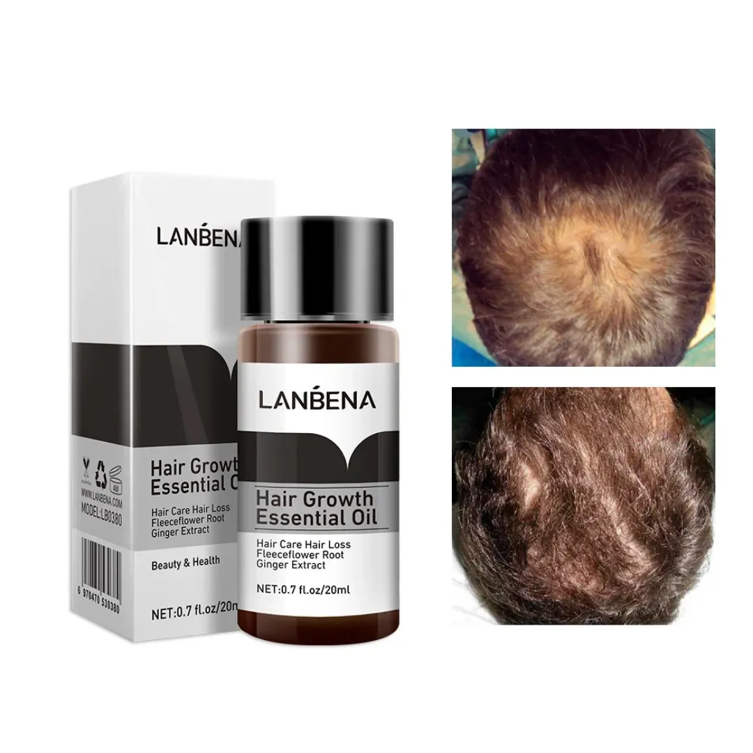 LANBENA Huile Essentielle Anti-Chute et Croissance des Cheveux 20ml
