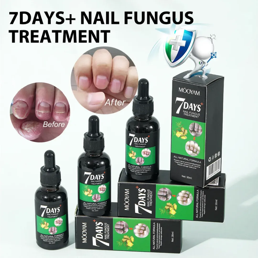 Sérum de traitement des champignons des ongles 7 jours MOOYAM 30ml