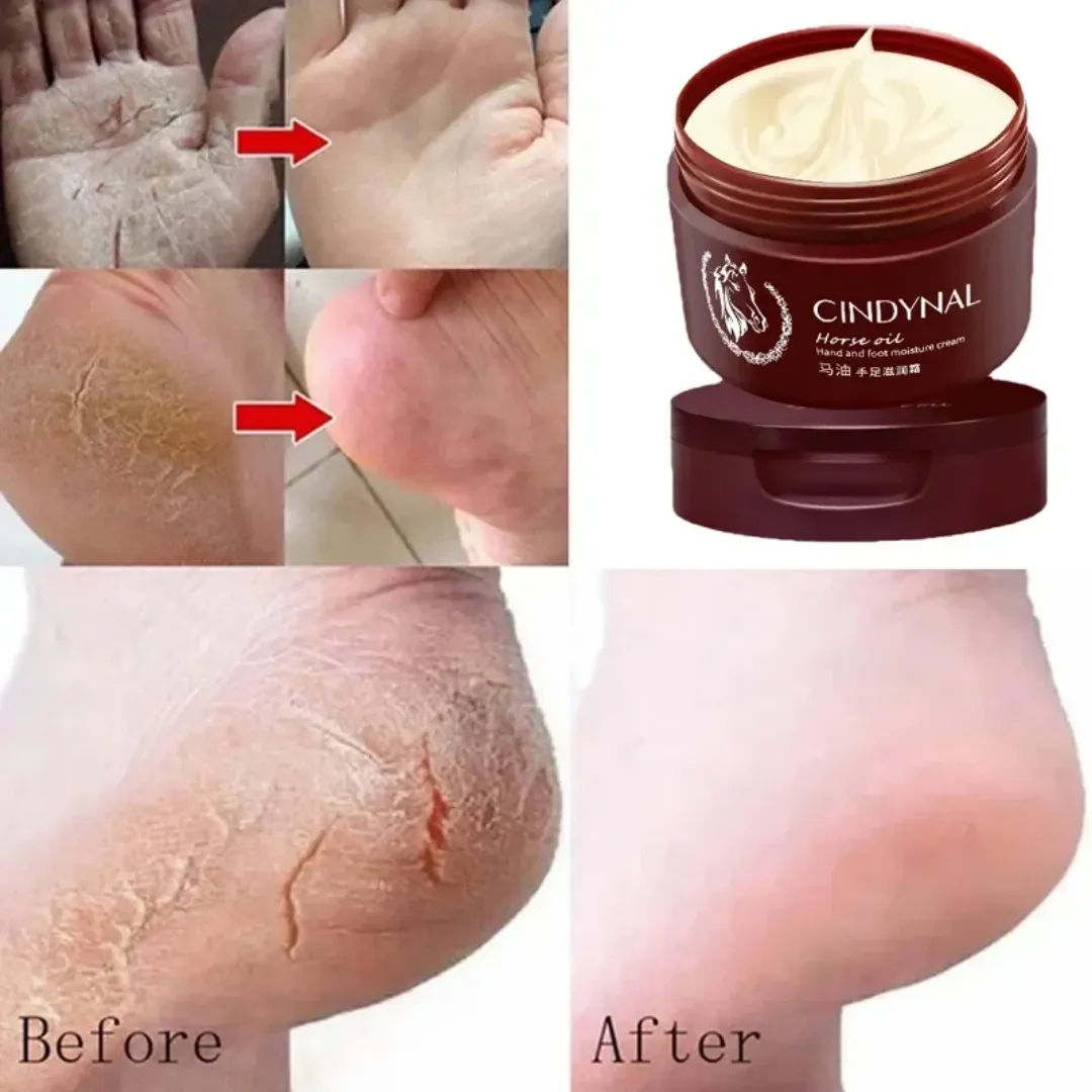 Crème pour les pieds réparatrice anti-fongique exfoliante et hydratante