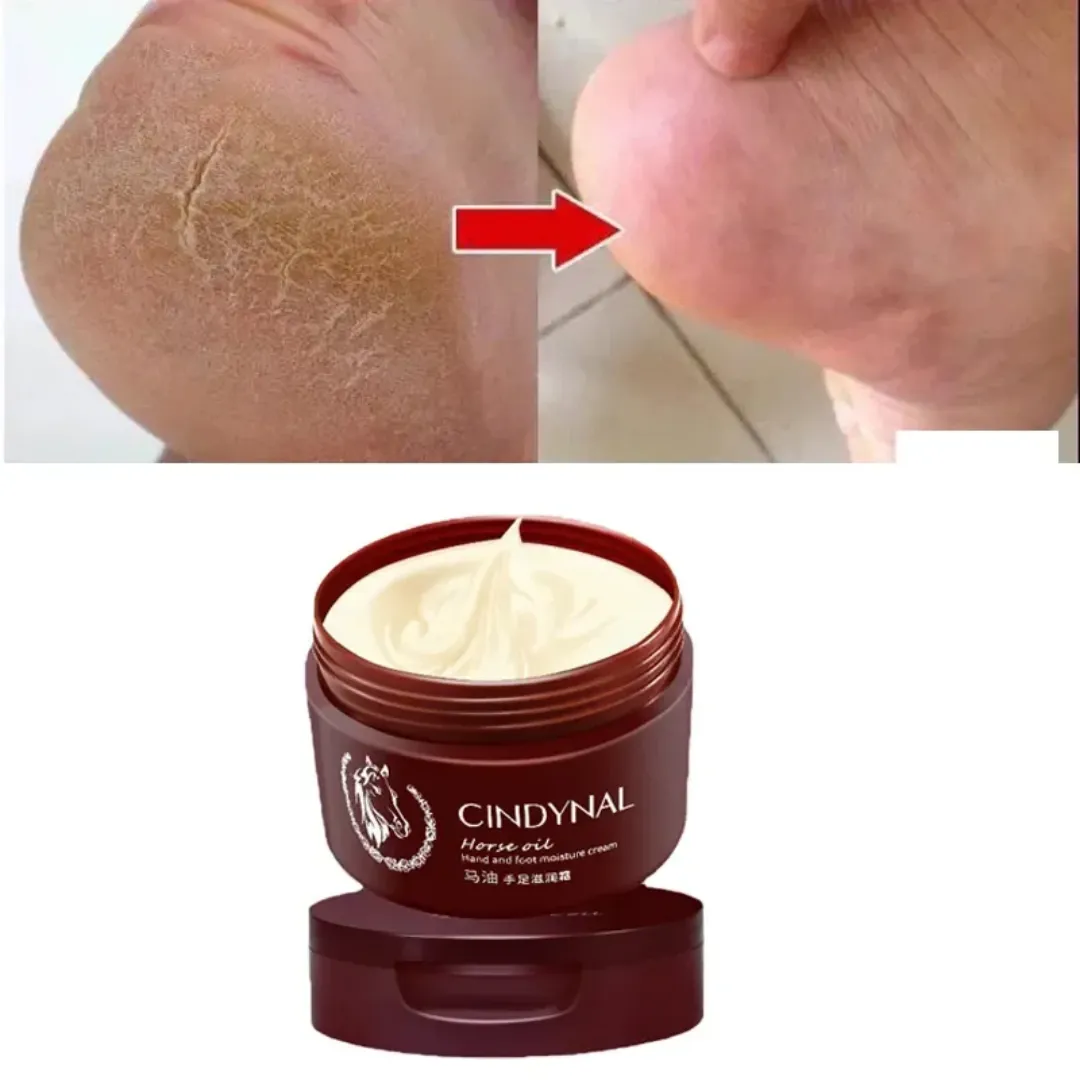 Crème pour les pieds réparatrice anti-fongique exfoliante et hydratante