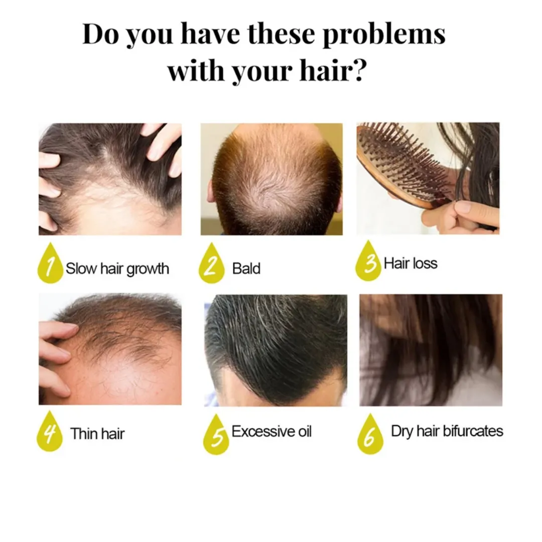 EELHOE Savon au riz Longsheng pour la croissance des cheveux