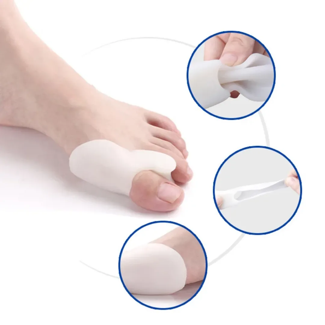 Correcteur orteil Silicone Bunion pouce Valgus protecteur empêchant les ampoules outils à ongles soins des pieds séparateurs d'orteils